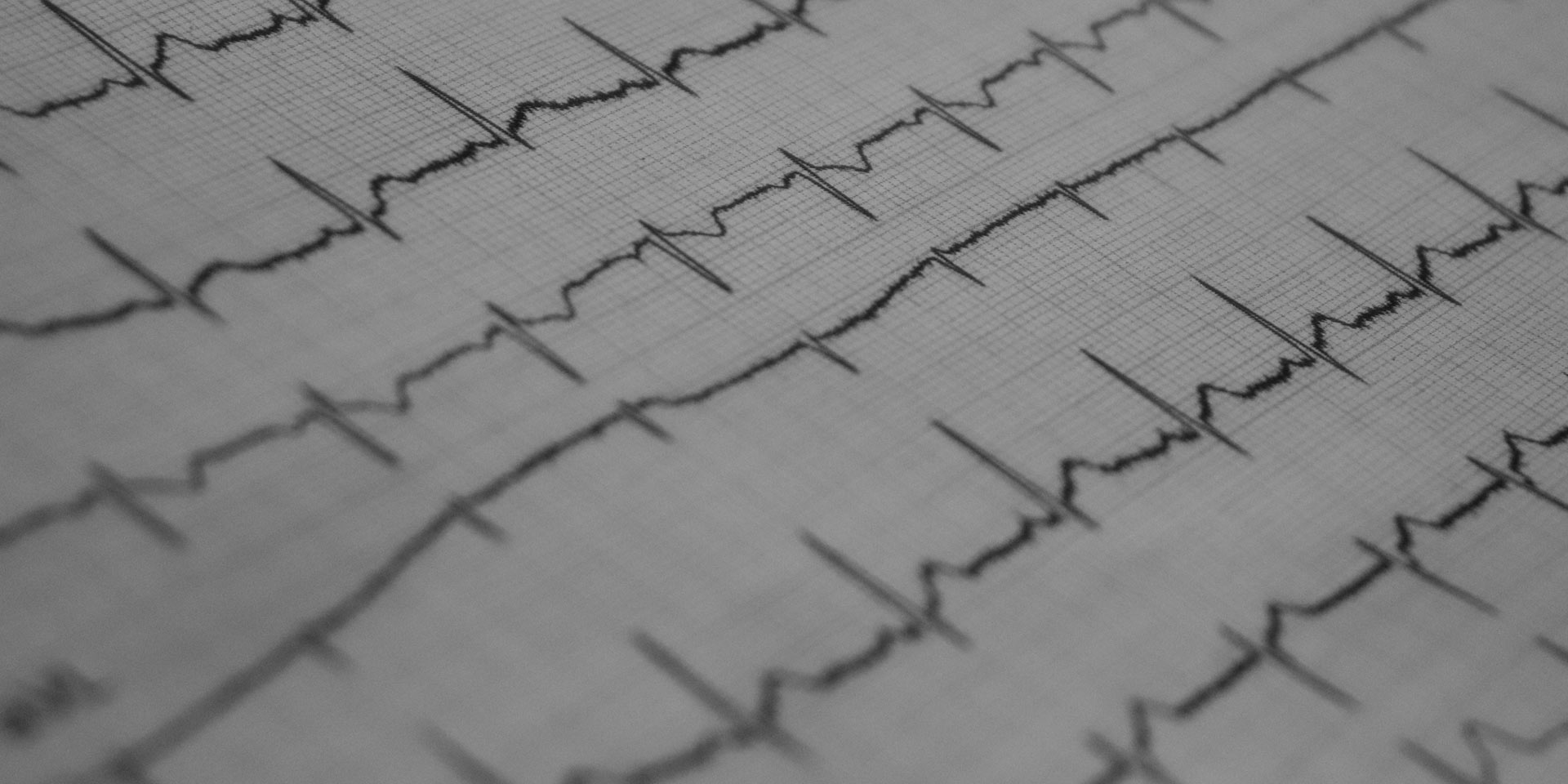 ekg from a physician ekg von einem arzt