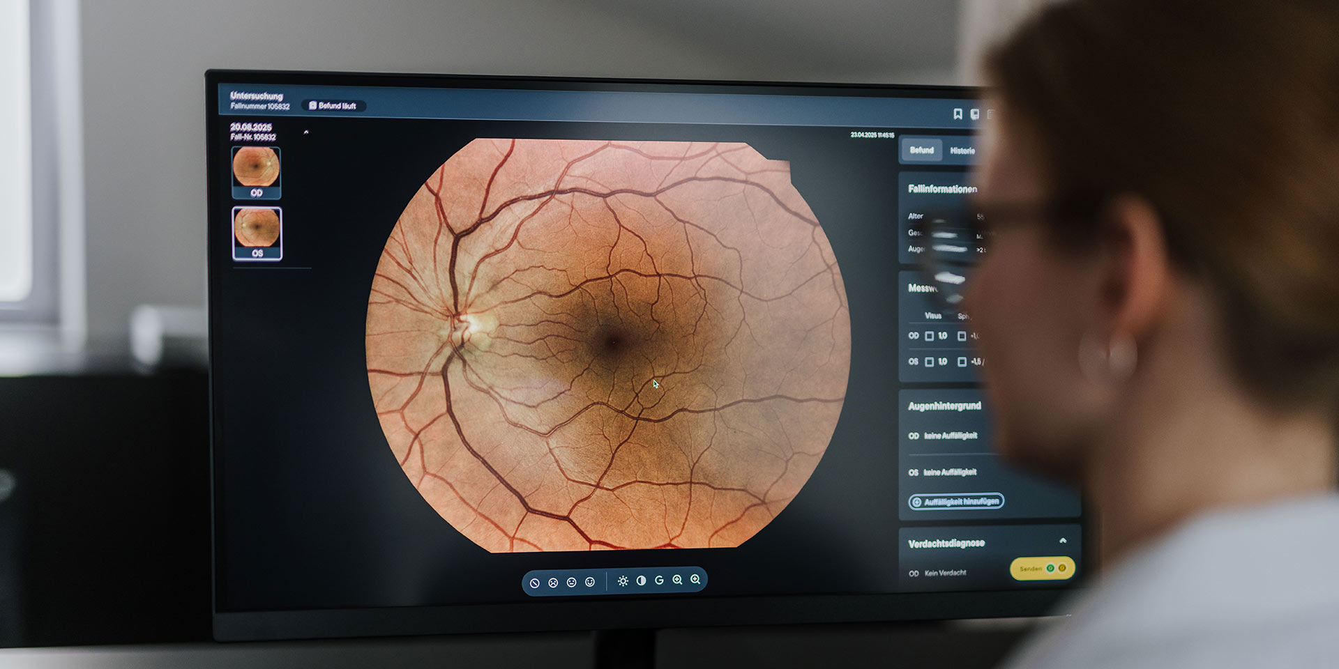 wenn mone telemedizin  vernetzte versorgung  augenlicht retten